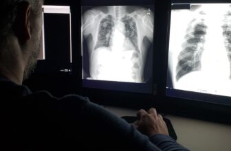 Lung Power Peaks in Our 20s—and It’s a Steady Decline From There, Study Finds