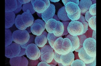 Alaskan Woman’s Death From Gonorrhea Sparks Fears of a New Strain